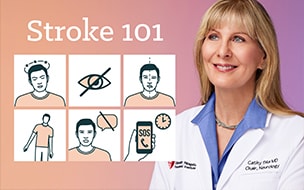 Dr. Cathy Sila with an illustration of Stroke 101