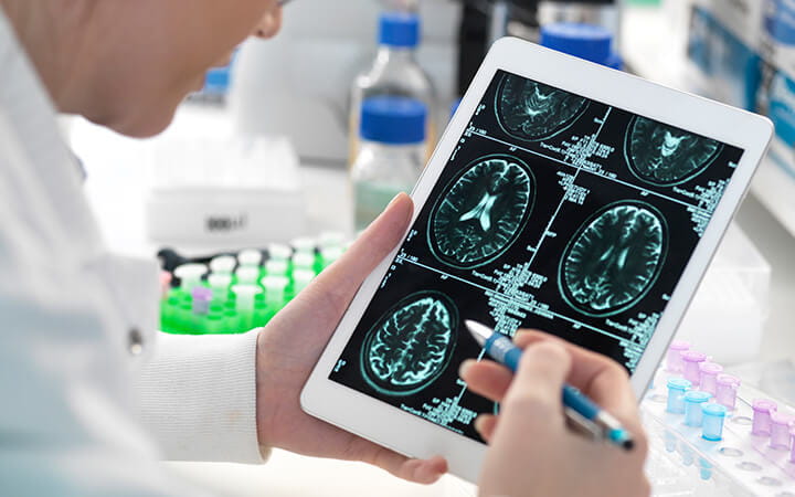 Doctor viewing patient's brain scan on digital tablet in laboratory