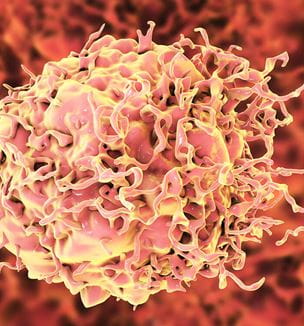 Colon cancer cell illustration Getty image