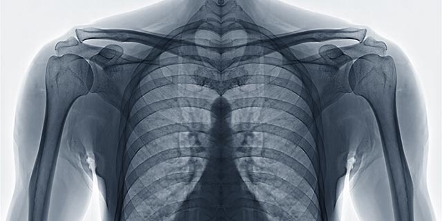 x-ray of chest wall