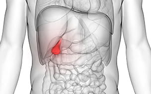 Gallbladder Disease and Treatment