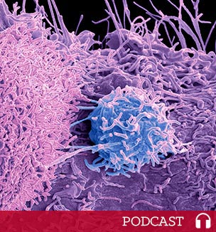 prostate cancer cells