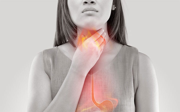 What Foods And Drinks Cause Acid Reflux? 
