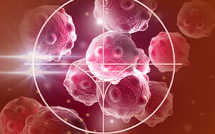 Illustration of cancer cells