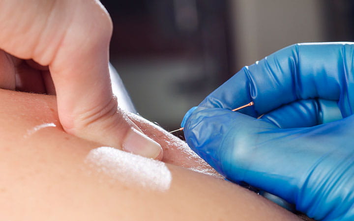 inserting needle in skin