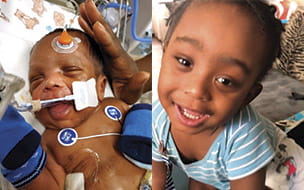 ”Jojo” Jones pictured before and after his kidney transplant procedure