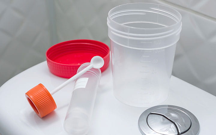 Medical kit for the sampling of feces and empty urine sample cup