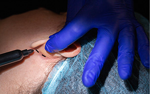 A plastic surgeon performs an operation to correct the ears of a female patient