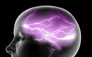 Illustration of purple lightning symbolizing epilepsy in brain of female figure