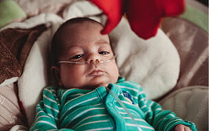 A baby wearing nasal canula and oxygen relaxes at home in a chair