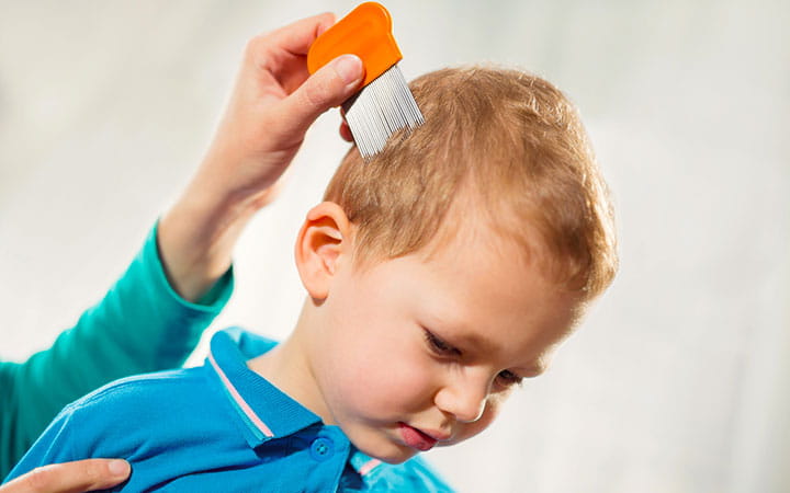 combing lice nits from child's head