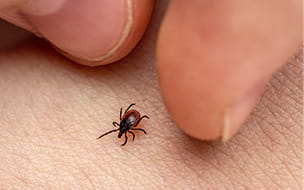 tick on human skin between a thumb and forefinger