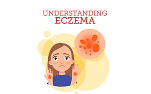 Understanding Eczema in Children