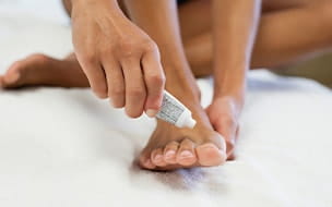 Woman applying cream to her toenail