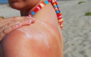 Woman applies suntan lotion