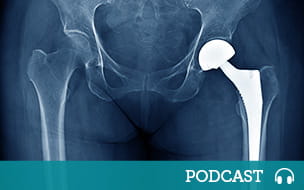 X-ray scan image of hip joints with orthopedic hip joint replacement