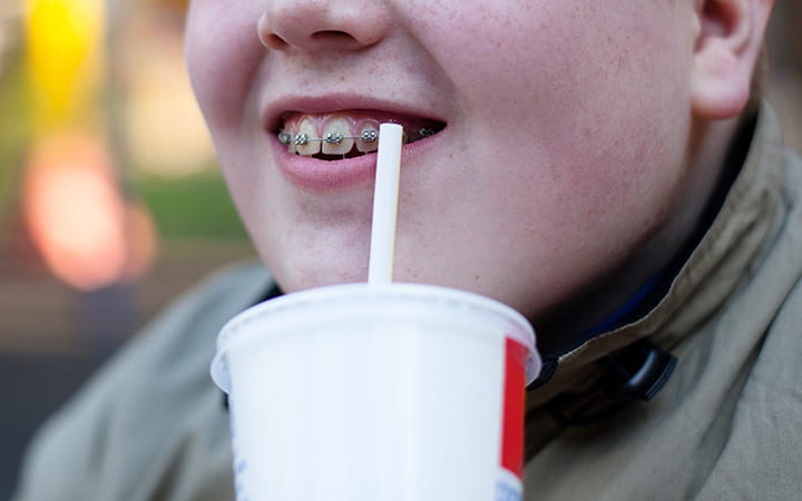 overweight boy with braces sipping a soft drink