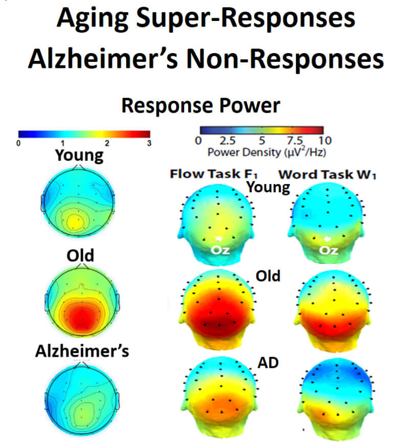 Dr. Duffy’s research on aging and Alzheimer’s disease has shown increased brain power use in aging that  precedes the loss of power with the development of impairments in Alzheimer’s disease.  