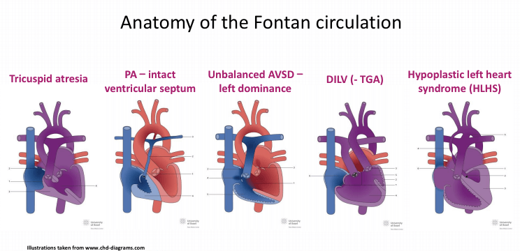 Anatomy of the Fontan circulation