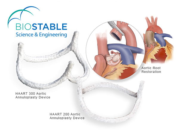 Biostable Aortic Repair illustration
