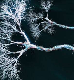 Neuron cell close up Getty image