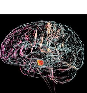 Getty image illustration of degeneration of this structure is characteristic of Parkinson's