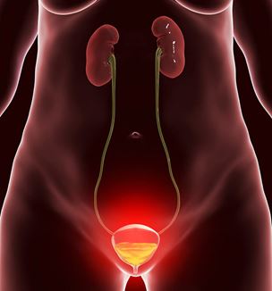 Getty image bladder cancer illustration
