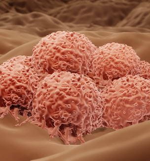 Melanoma cancer cell illustration