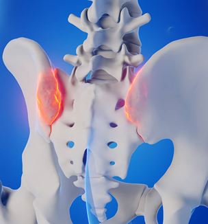 Getty image of joint SI pain