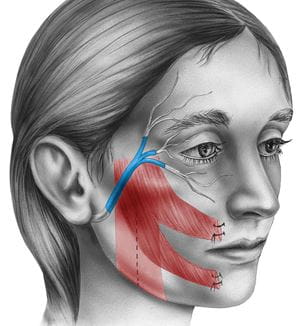 Photo of illustration of facial nerves