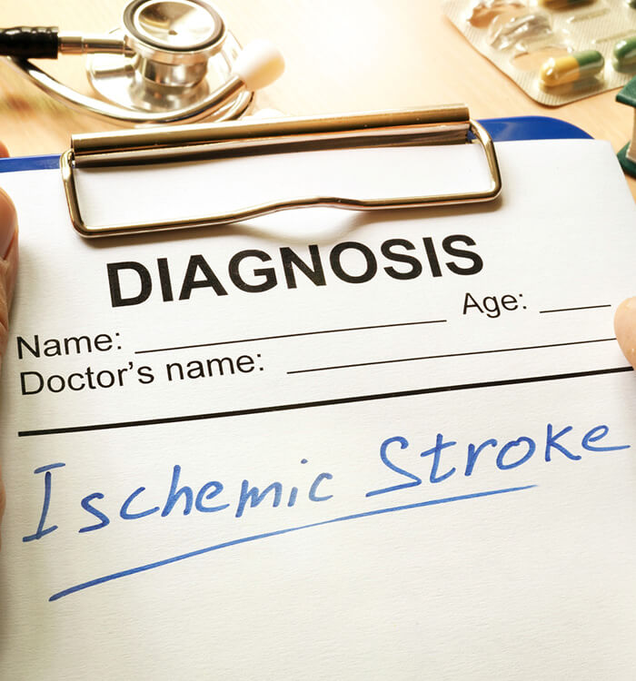 Ishcemic stroke written on diagnosis pad