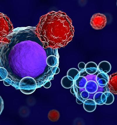 More Specific Approach to CAR T Cell Therapy Shows Promise for B Cell Cancers