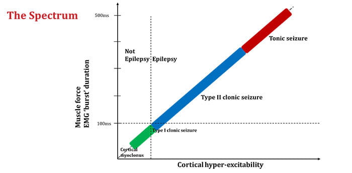 Hypothetical scheme demonstrating the spectrum of cortical motor responses from cortical myoclonus to a tonic seizure as a representation of increasing cortical hyper-excitability