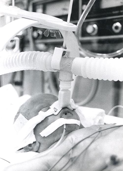 NICU patient on CPAP, circa 1973