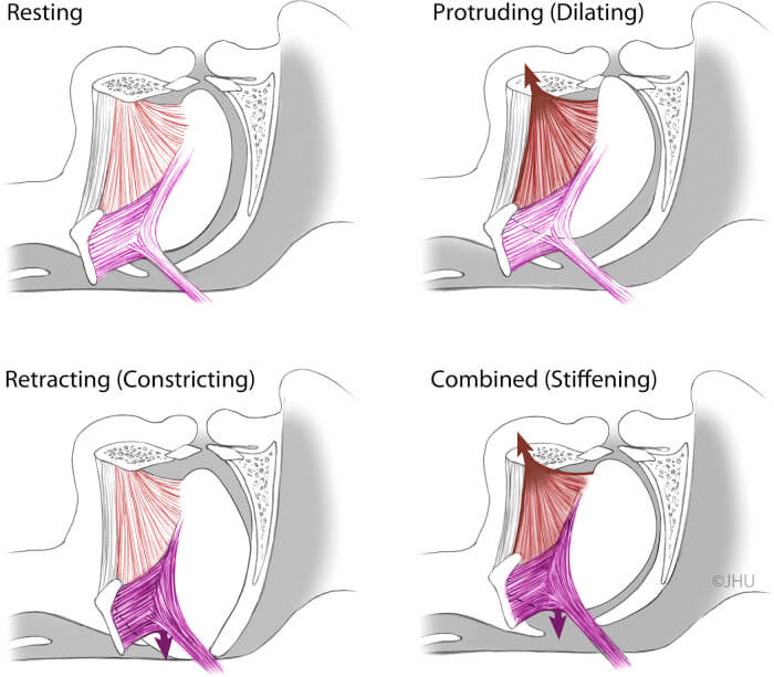Figure 1 Putative effects of tongue protrudor and retractor stimulation.