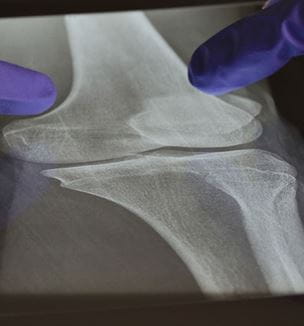 Orthopaedic image of bone x-ray