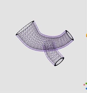 3D Airway stent software image