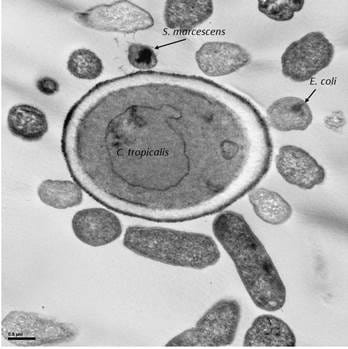 Transmission electron microscopy (TEM) showing the bacteria E.coli and S.marcescens surrounding the fungus Candica tropicalis