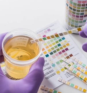 Getty image depicting urine drug testing