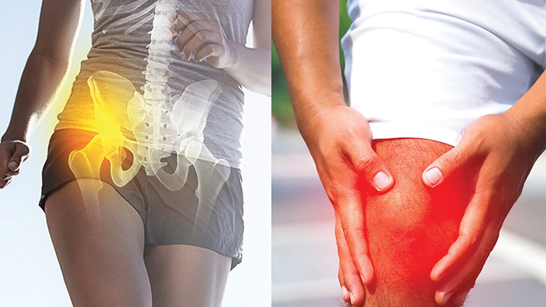 Hip and Knee Pain University Hospitals