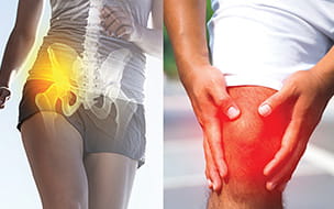 Hip and Knee Pain