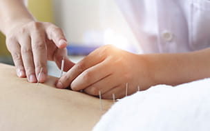 Acupuncture in Orthopedics and Sports Medicine