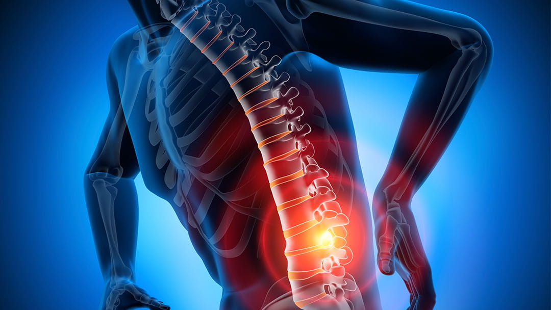 Low Back Pain Cause Nonsurgical and Surgical Treatments University