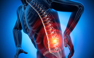 Low Back Pain - Cause Non-surgical and Surgical Treatments
