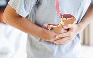 GERD - Gastroesophageal Reflux Disease - Myths and Facts