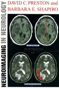 Neuroimaging in Neurology
