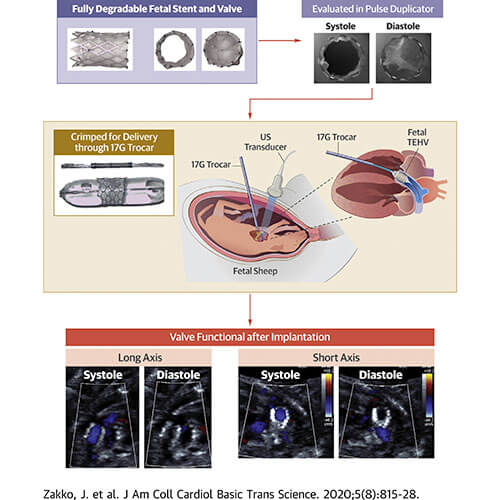 model for percutaneous implantation of tissue engineered heart valves