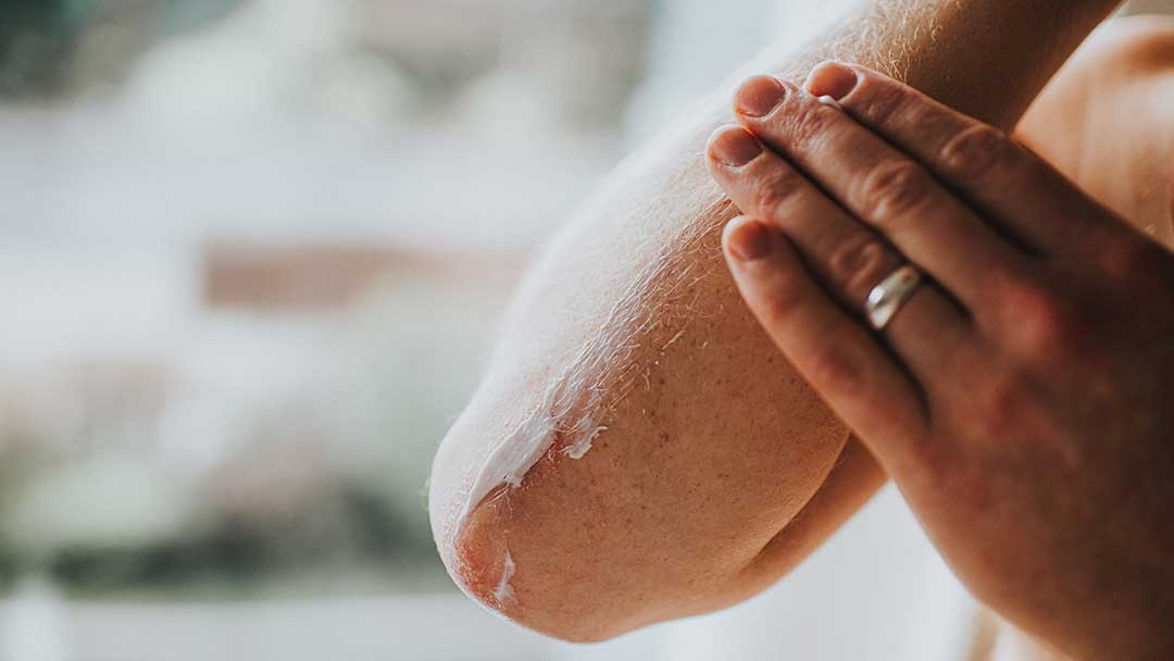 dry skin with rash
