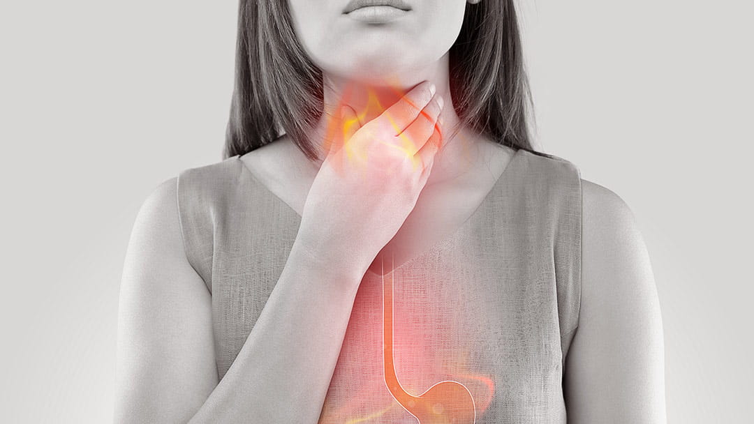 The Best and Worst Foods for Acid Reflux