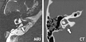 MRI and CT images courtesy of the National Institutes of Health, Department of Health and Human Services